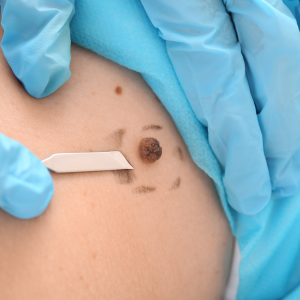 Transforming Lives: How Skiniva Skin Clinic Helps You Embrace Your True Beauty