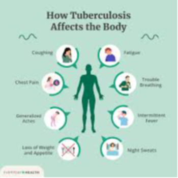 Breathing Easy: How Chest Clinic in Pune Transforms Lives with Allergy, Asthma, and TB Treatment