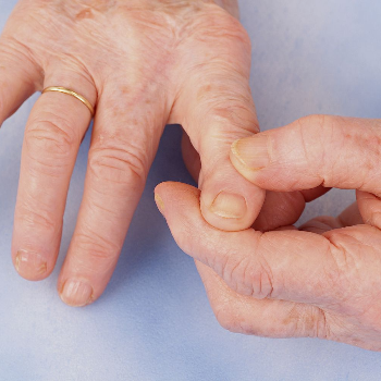 Healing Hands: Transforming Lives with Opportunistic Treatment