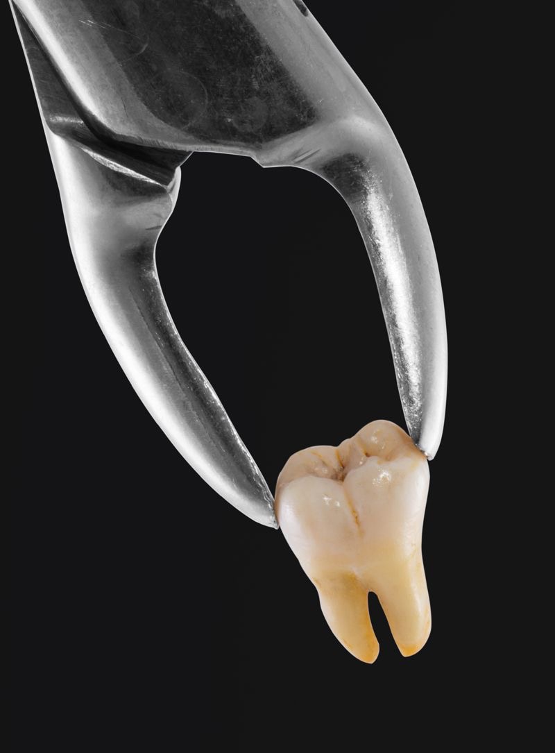 Transforming Smiles: The Journey of Radhika and Her Dental Dilemma