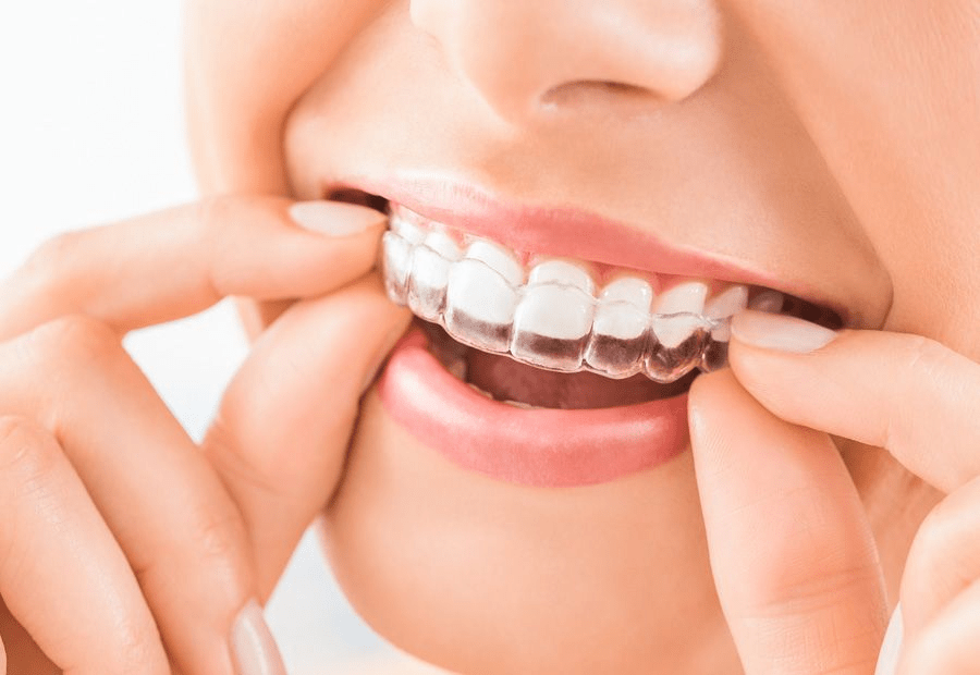 Transforming Smiles: How Invisible Braces Changed Ananya's Life | My family dentist dental implant center (MFD-HARIDWAR)