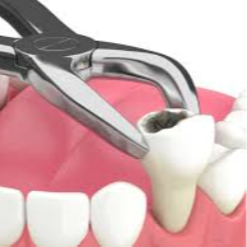 Transforming Smiles: How Rakesh Found Relief with Sai Dental’s Extraction Services