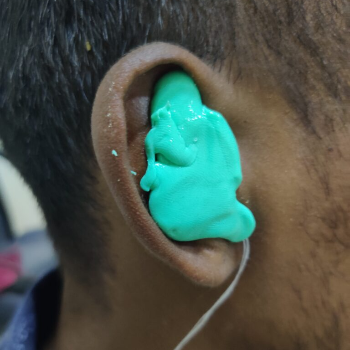 Embracing Sound: How Ear Impressions Transformed Ravi's World