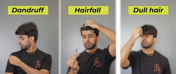 How Rohan Overcame Hairfall and Dandruff Woes with a Trusted Salon