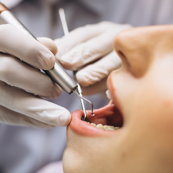 Transforming Smiles, Transforming Lives: The Impact of a Root Canal Specialist