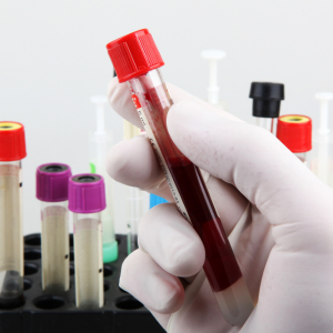 Transforming Health: How a Reliable Blood Test Service Changed Priya’s Life