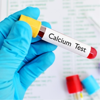 Reclaiming Health: How Calcium Supplements Transformed Priya’s Life