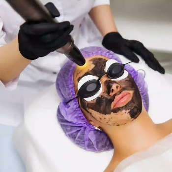Transform Your Skin with Carbon Facial: A Game-Changer for Indian Women