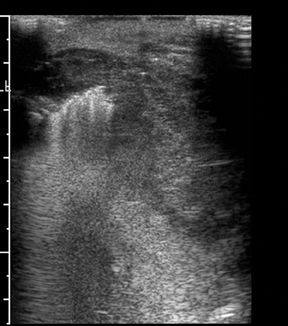 Empowering Lives with Thyroid, Scrotal & Breast Ultrasound: A Journey to Health