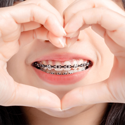 Transforming Smiles: How Orthodontic Treatment Changed Priya's Life | Songara Dental Clinic