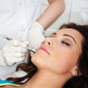 Revitalize Your Glow: How Medifacial Treatments at Skiniva Transformed Meera's Skin