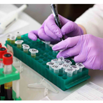 Empowering Health: How Serology is Revolutionizing Diagnostics in India Indian Institute Ramway Plaza, Kharivav Rd, Dandia Bazar, Jambubet, Vadodara, Gujarat 390001