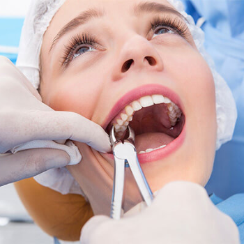 Transforming Smiles, Changing Lives: The Impact of Cosmetic Dental Extractions