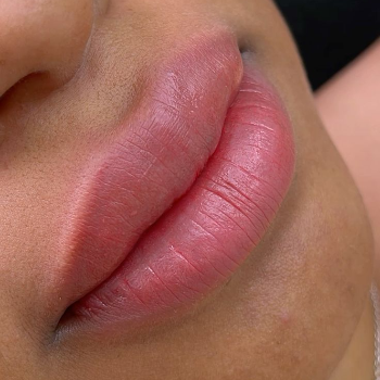Enhancing Confidence: How Lip Micro-Pigmentation Transformed Riya’s Life