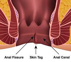 Healing Beyond Pain: A Journey Towards Comfort and Relief