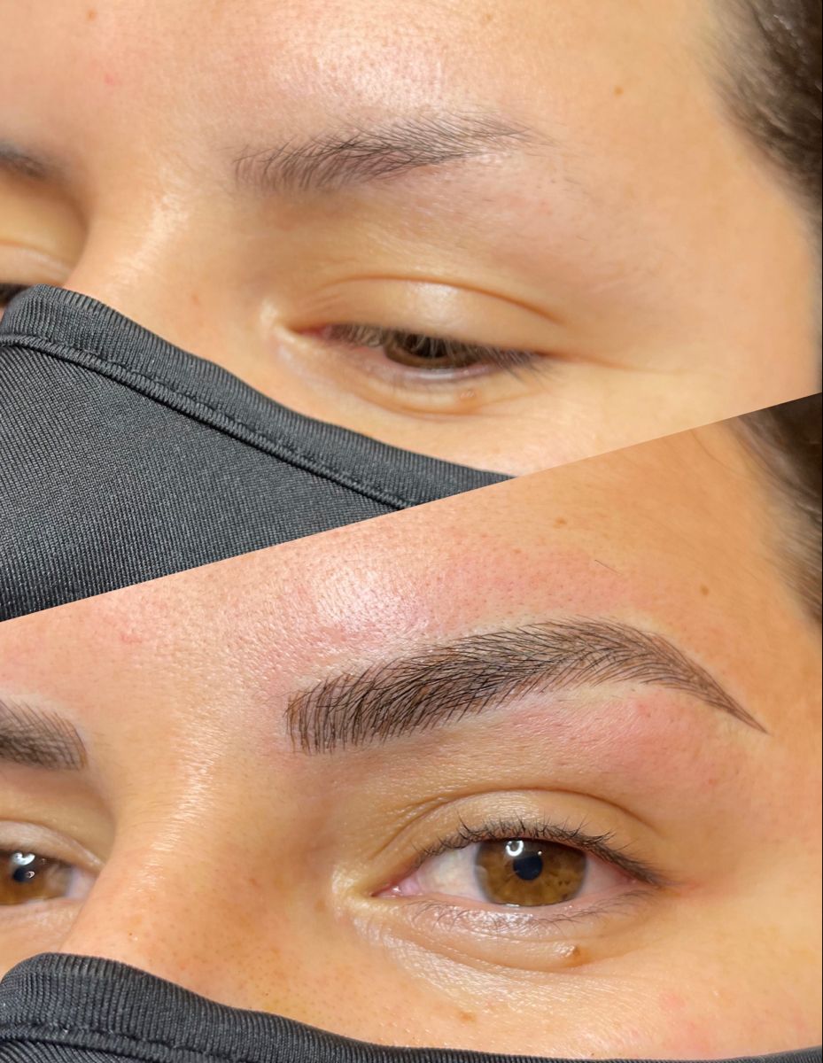 Embrace Confidence with Microblading: Shreya's Transformation Journey