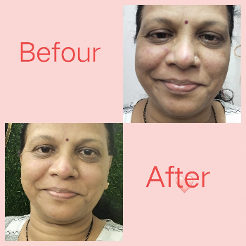 Transform Your Skin and Confidence with Our Facial and Cleanup Services