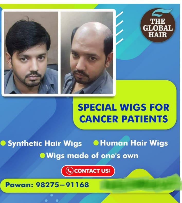 Embracing Confidence: How Wigs Transform Lives for Cancer Patients