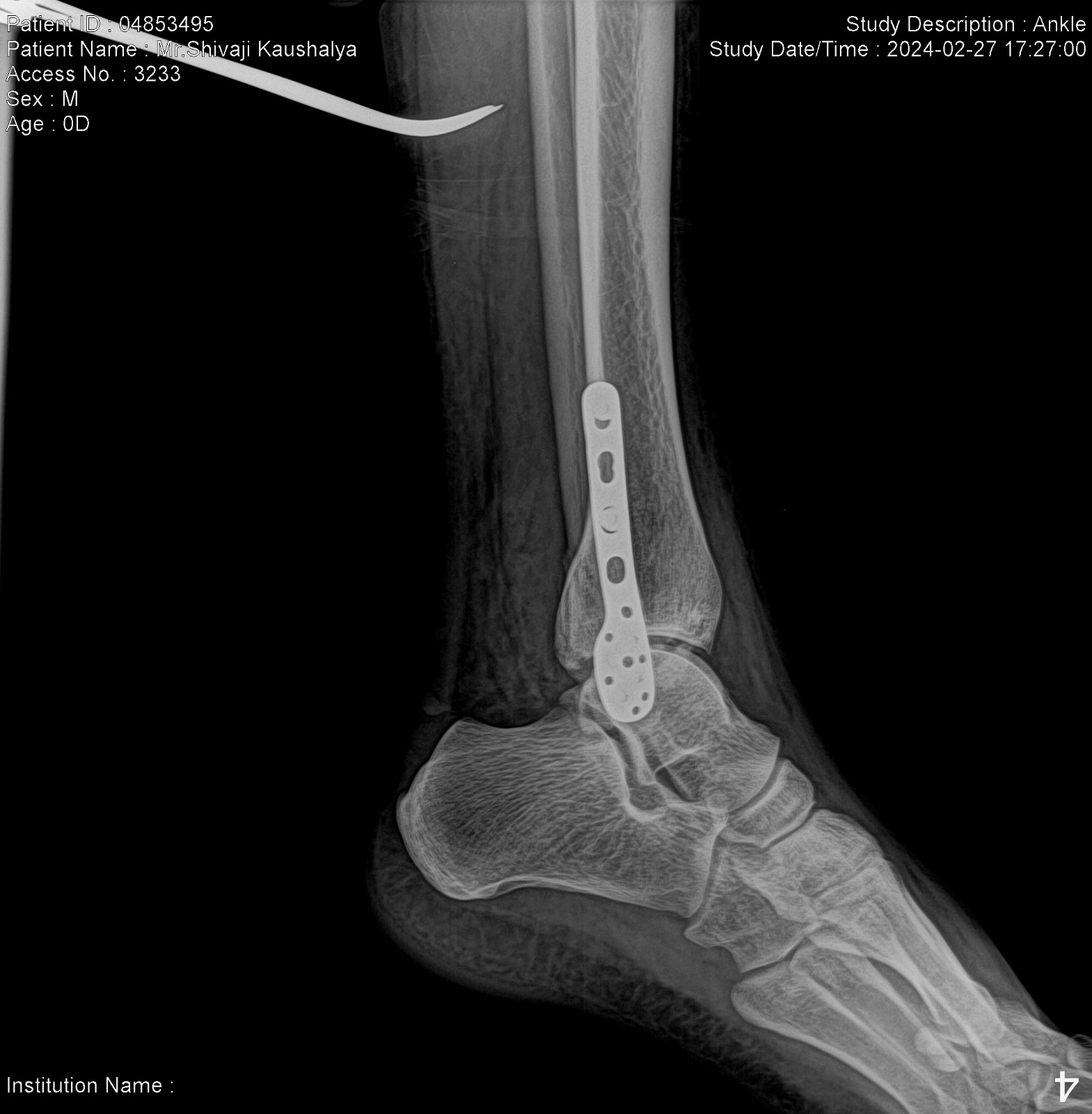 Transforming Visions into Reality: How High-Resolution Imaging is Revolutionizing Industries