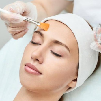 Unveil Your Radiant Skin: How Chemical Peels Transformed Ananya's Life