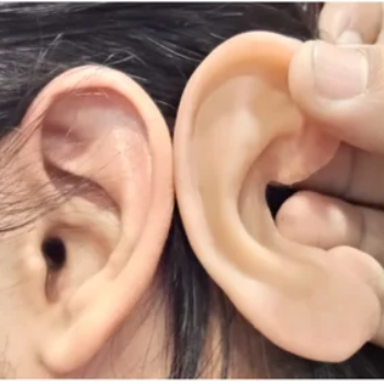 Restoring Sound and Confidence: Rajesh's Journey with Ear Prosthesis | CARE TOUCH VISION CENTRE