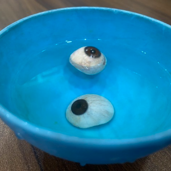 Transforming Lives: How Hollow Prosthesis Eyes Bring Hope to Many | CARE TOUCH VISION CENTRE