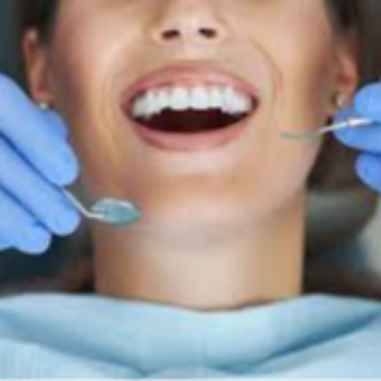 Transforming Smiles: How a Dental Consultation Changed Meera's Life