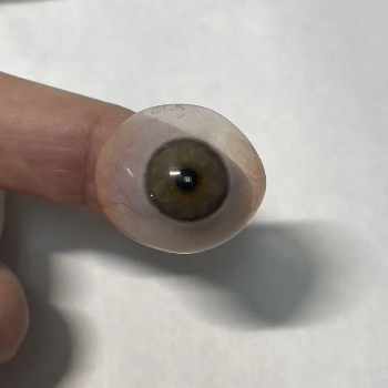 Transforming Lives: How Thin Scleral Shells Bring Clarity and Confidence | CARE TOUCH VISION CENTRE