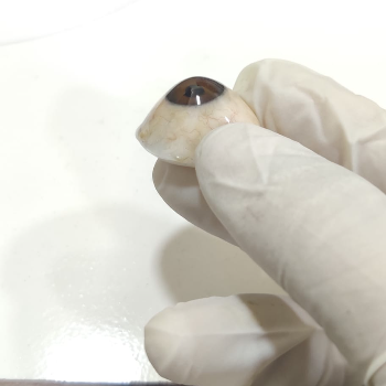 Transforming Lives: How Custom Prosthetic Eyes Empower Individuals to Embrace Their Unique Journey | CARE TOUCH VISION CENTRE