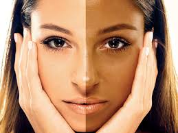 Embrace Your Glow: How De-Tan Treatments Transformed Priya's Skin | SKIN | HAIR | MAKEUP |