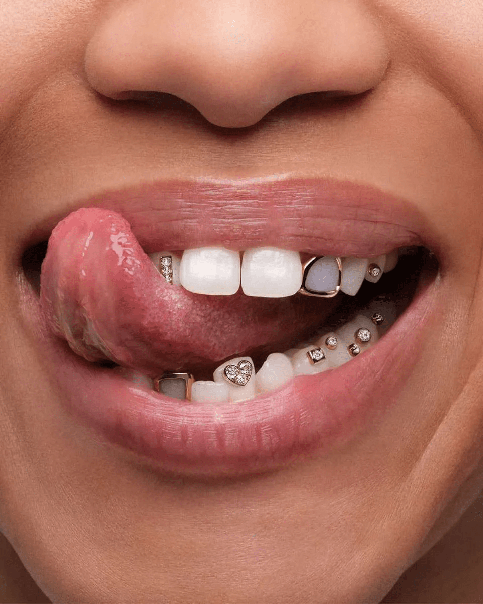 Sparkle with Confidence: How Tooth Jewellery Transforms Smiles and Lives | My family dentist dental implant center (MFD-HARIDWAR)