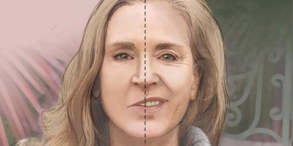 Healing with Hope: A Journey Through Facial Paralysis and Nerve Numbness