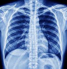 Transforming Healthcare: How Digital X-Rays Revolutionize Patient Experience at Sanya Karond Imaging Center