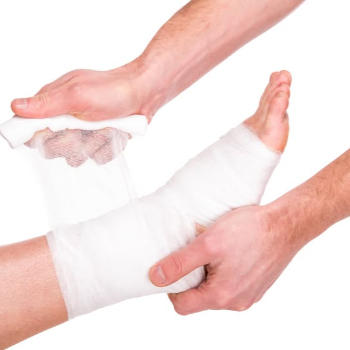 Healing Journeys: Overcoming Varicose Veins and Non-Healing Wounds in India