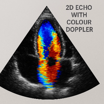 Finding Peace Through Precision: How 2D Echo with Colour Doppler Transformed Rajesh's Health Journey