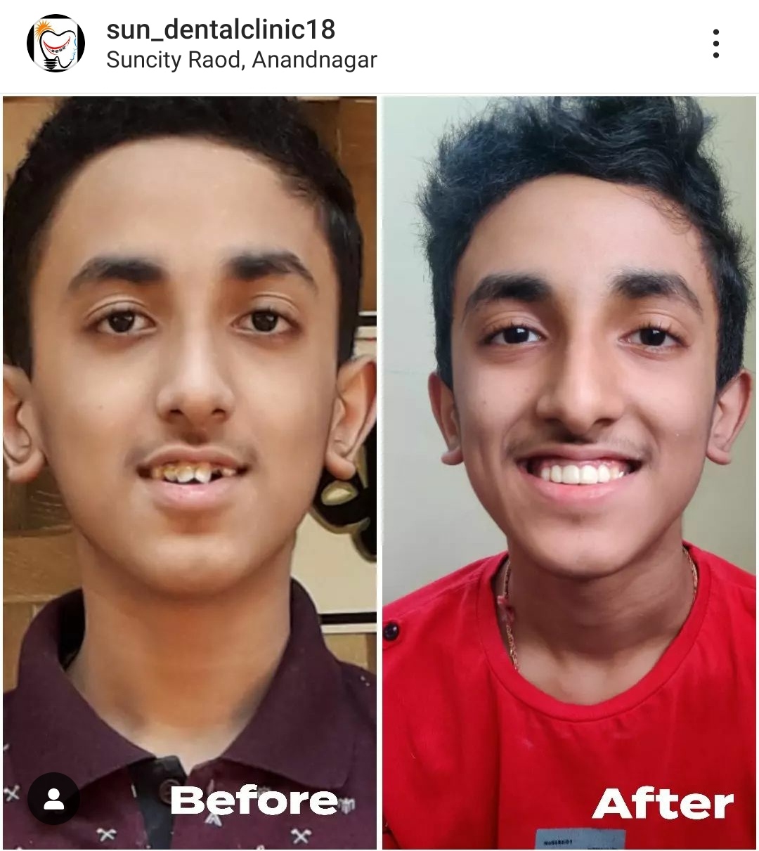 Transforming Smiles: How Cosmetic Dentistry Revives Confidence