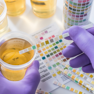 The Journey to Health: How Shriraj Diagnostic Centre Transforms Lives with Urine Testing Services