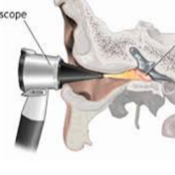Rediscover the World of Sound: How Ear Plus Hearing Solutions Transformed Raj's Life