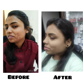 Unveil Radiant Skin: The Transformative Power of Herbal Glow Facials | Magic Touch Beauty Parlour