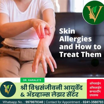 Finding Relief: How Shri Vishwasanjeevani Transformed Meera's Life with Allergy Treatment