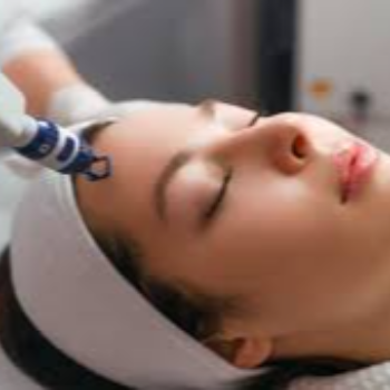 Revitalize Your Skin: How CO2 Fractional Laser Transformed Anita's Life