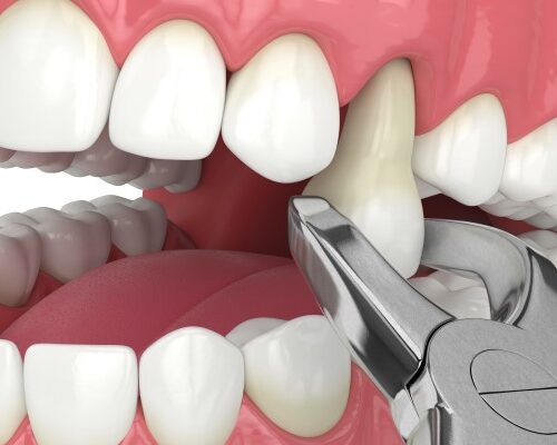 Transforming Smiles: How Tooth & Co. Solves Dental Woes with Compassion and Precision