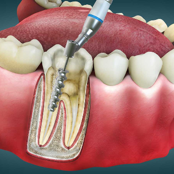 Transforming Smiles, Transforming Lives: Dental Treatments for Systemic Health