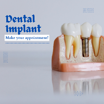 Rediscover Your Smile: How Dental Implants Transformed Meena's Life