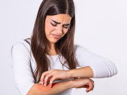 Finding Relief: How Dr. Shweta's Homoeopathic Healthcare Transforms Lives with Skin Allergy Solutions