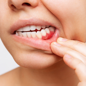 Transforming Smiles, Transforming Lives: A Journey through Periodontal Gum Care