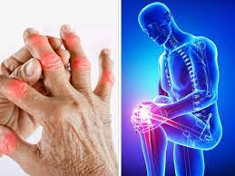 Transforming Lives: How a New Solution Brings Relief to Sanjay’s Arthritis Struggles