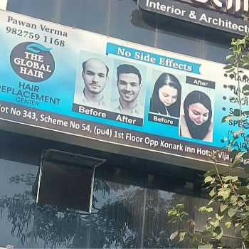 Transforming Lives: A Journey to Renewed Confidence with Hair Replacement