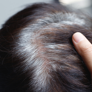 Discover the Secret to Reversing Premature Graying Naturally