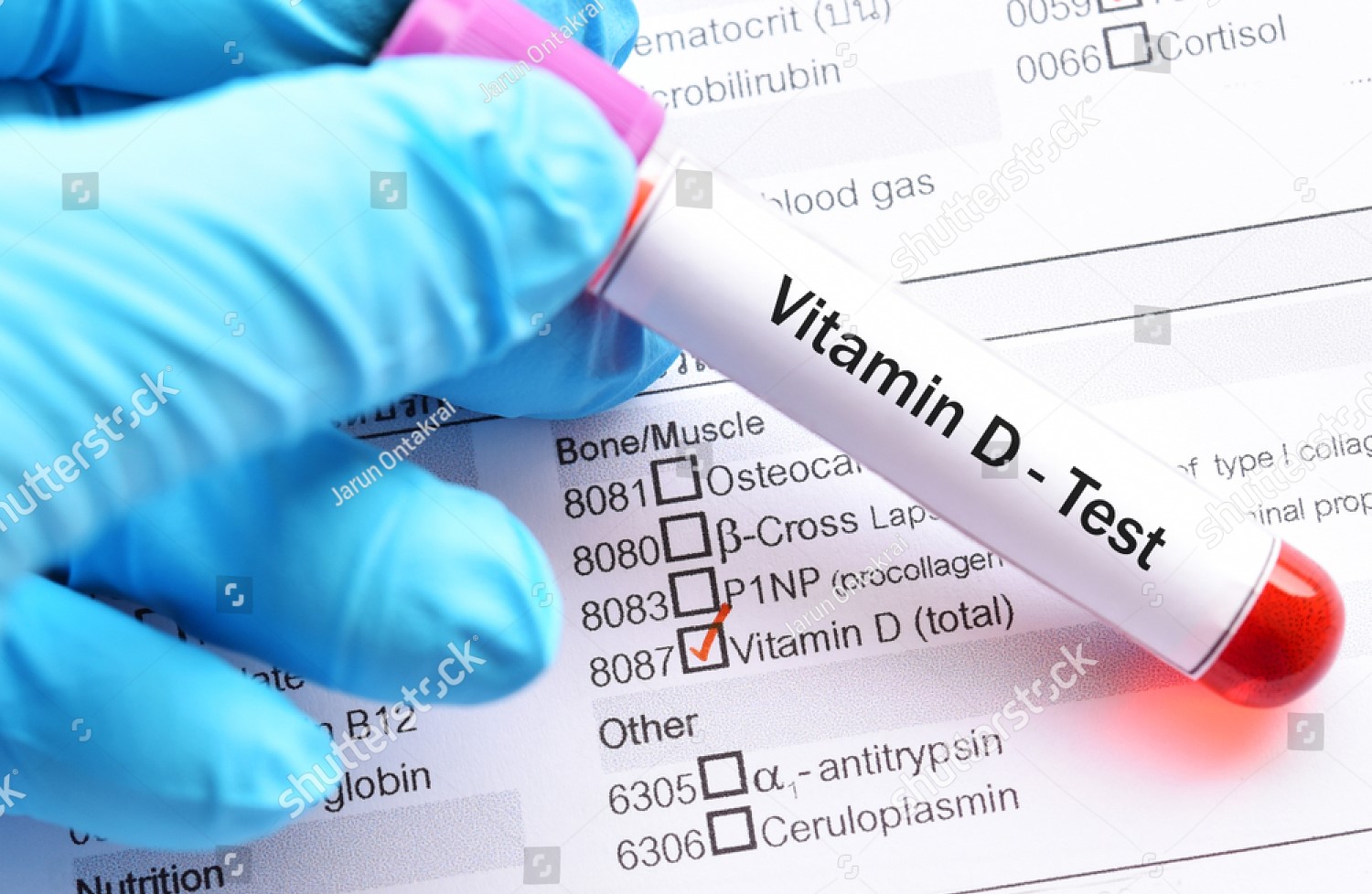 How Vitamin D Transformed Arjun's Health: A Journey to Wellness